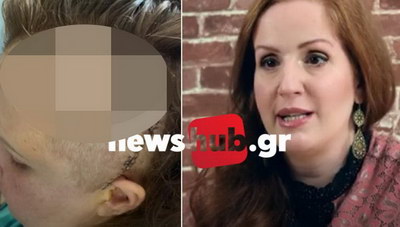 ΑΠΟΚΛΕΙΣΤΙΚΟ: Είχε διπλό ανεύρυσμα στον εγκέφαλο και νίκησε για την οικογένεια της!