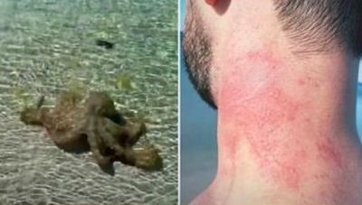 Eπίθεση από... οργισμένο χταπόδι σε τουρίστα (video)