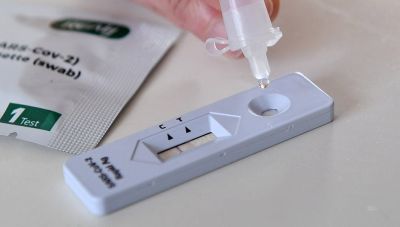 Δ. Σαρηγιάννης: Να κάνουν self test και οι εμβολιασμένοι εργαζόμενοι
