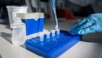 Δωρεάν PCR ανακοίνωσε ο Υπουργός Υγείας- Που θα γίνονται