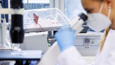 Παγώνη για Ευλογιά των Πιθήκων: Απαραίτητη η καραντίνα για όσο διαρκεί