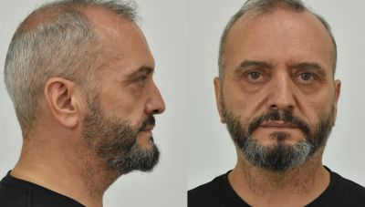 Ο 53χρονος εξέδιδε τη 12χρονη και σε «ηθοποιούς, καλλιτέχνες και πολιτικούς»-Νέα σοκαριστική καταγγελία