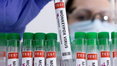 Ευλογιά των πιθήκων: Συνολικά 58 τα κρούσματα στην Ελλάδα-Όλοι άνδρες