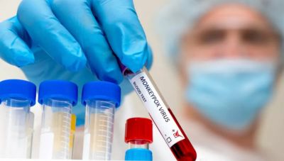 Ευλογιά των πιθήκων: Συναγερμός και στην Ευρώπη-Στη Σουηδία το πρώτο κρούσμα εκτός Αφρικής