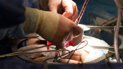 Έλληνας δώρησε τμήμα ήπατος στην 11 μηνών κόρη του: Επιτυχής μεταμόσχευση στο Τορίνο