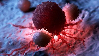 Κρήτη: Ενημερωτική εκδήλωση για τον καρκίνο στην Κίσσαμο