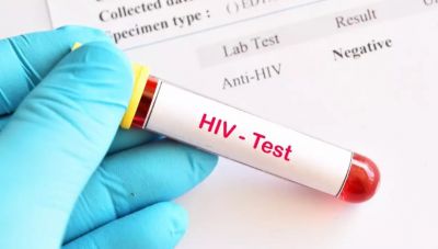 AIDS: Ένας στους 10 Έλληνες που είναι φορείς δεν το γνωρίζουν-Απογοητευτικά στοιχεία του ECDC