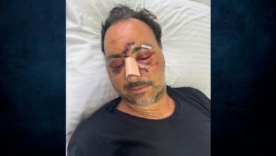 Ηράκλειο: Το κεφάλι του Ελληνοκαναδού ηταν σπασμένο σε τρία σημεία - Στην Εισαγγελία η δικογραφία  - Τι λέει ο δικηγόρος του