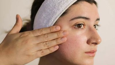 Μελάνωμα: Η «αθώα» δερματική πάθηση που αυξάνει τον κίνδυνο