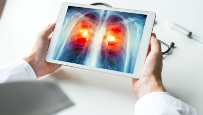 Χημειοθεραπεία  - Προληπτική χορήγηση: Απαντήσεις σε κρίσιμα ερωτήματα