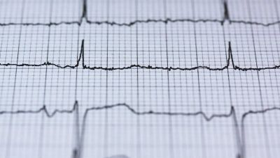 Καρδιακή ανακοπή: Τα συμπτώματα που προειδοποιούν λίγες ώρες νωρίτερα