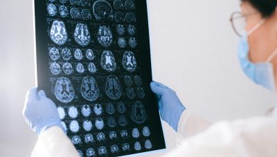 Νόσος Alzheimer και άνοια: Ξεκινάει ενημέρωση στα σχολεία Πρωτοβάθμιας Εκπαίδευσης Ηρακλείου