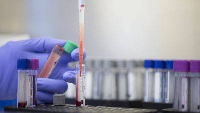 Οι επιστήμονες ανακάλυψαν μια νέα ομάδα αίματος μετά από 50 χρόνια έρευνας