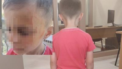 Σοκ στο Αγρίνιο: Μαθητής νηπιαγωγείου έδειρε συμμαθητή του (Φωτο)