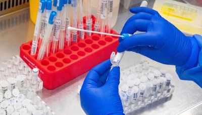Ενημερωτική εκδήλωση για τα βλαστοκύτταρα από τη ΔηΤΟΒ Κρήτης, την Ιατρική Σχολή του Π. Κρήτης και το ΙΤΕ