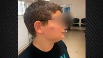 Ξυλοδαρμός 11χρονου σε σχολείο της Θεσσαλονίκης - Η διευθύντρια πρότεινε «να μην δίνει σημασία» καταγγέλλει η μητέρα
