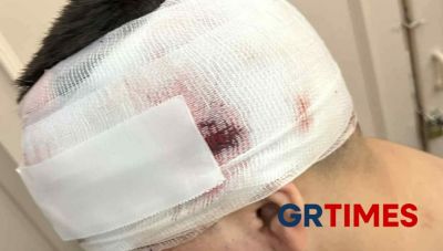 Θεσσαλονίκη: 11 τα άτομα που επιτέθηκαν στον 13χρονο – Συνελήφθη 18χρονος, συνεχίζεται η έρευνα για τους υπόλοιπους