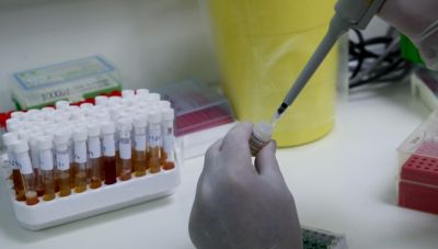 ΕΟΔΥ: 15 θάνατοι από γρίπη και 7 από Covid-19 την τελευταία εβδομάδα