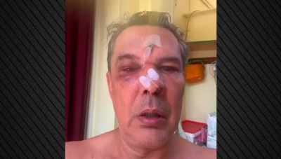 Απίστευτο περιστατικό στο Χαϊδάρι: Ξυλοκόπησε άγρια άνδρα μέσα σε ιατρείο όταν του έκανε παρατήρηση να μιλά πιο σιγά στο κινητό